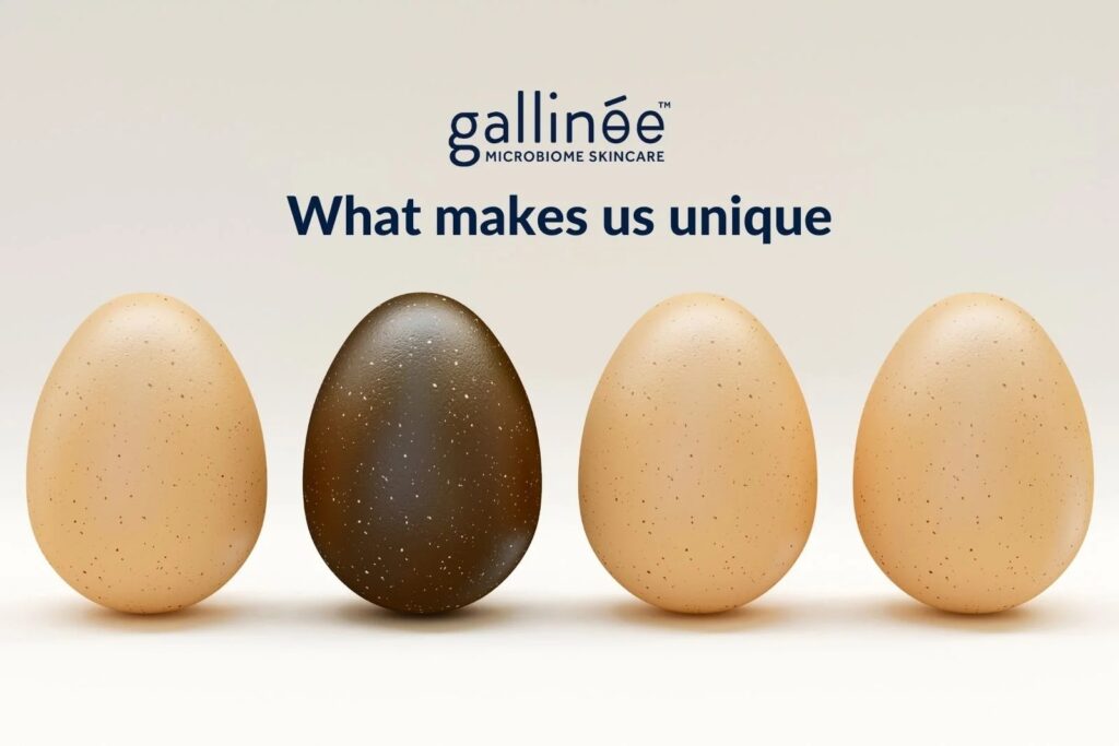 whats so special about gallinee